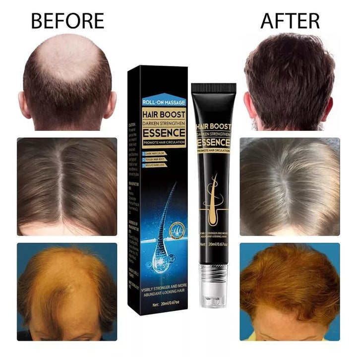 Serum acelerador y fortalecedor ✨ Deluxe MAX 💇🏼‍♀️ (Estimula el crecimiento en días)