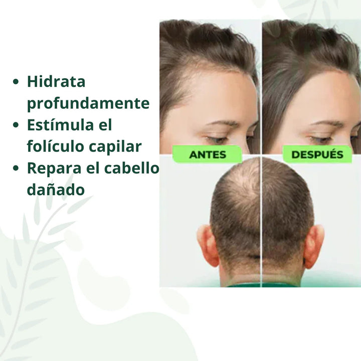 Tónico acelerador & fortalecedor capilar⚡️ POWER NATURAL 💇🏼‍♀️ (2x1 Crecimiento acelerado 15 días)