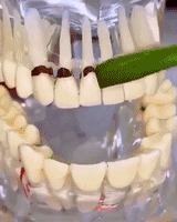 KIT Limpieza dental  profesional 😁 WHITE PRO™✨(7Piezas)